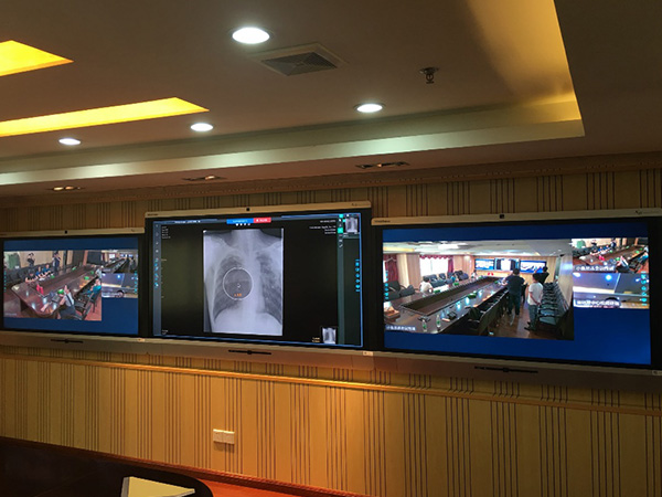 广东省结核病医院远程会诊